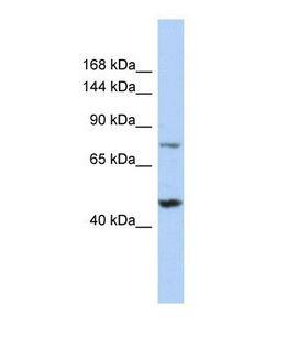MGA / MAD5 Antibody - Western blot of Human 721_B. MGA antibody dilution 1.0 ug/ml.  This image was taken for the unconjugated form of this product. Other forms have not been tested.