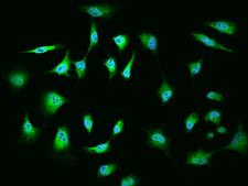 MGA / MAD5 Antibody - Immunofluorescence staining of MGA in HeLa cells. Cells were fixed with 4% PFA, permeabilzed with 0.1% Triton X-100 in PBS, blocked with 10% serum, and incubated with rabbit anti-Human MGA polyclonal antibody (dilution ratio 1:200) at 4°C overnight. Then cells were stained with the Alexa Fluor 488-conjugated Goat Anti-rabbit IgG secondary antibody (green) and counterstained with DAPI (blue). Positive staining was localized to Nucleus and Cytoplasm.