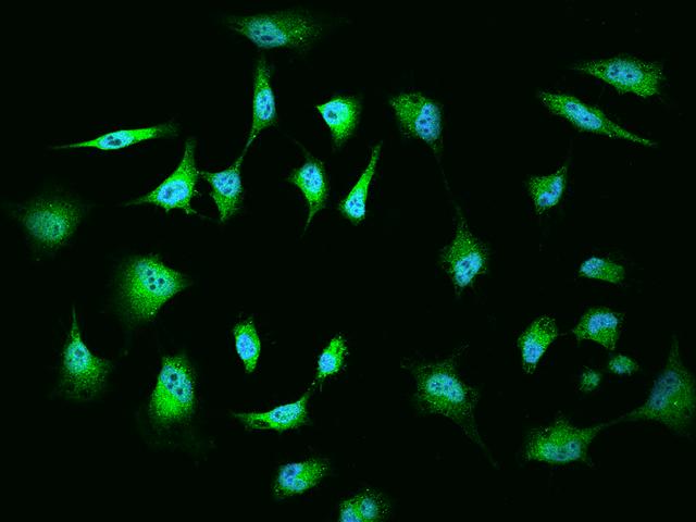 MGA / MAD5 Antibody - Immunofluorescence staining of MGA in HeLa cells. Cells were fixed with 4% PFA, permeabilzed with 0.1% Triton X-100 in PBS, blocked with 10% serum, and incubated with rabbit anti-Human MGA polyclonal antibody (dilution ratio 1:200) at 4°C overnight. Then cells were stained with the Alexa Fluor 488-conjugated Goat Anti-rabbit IgG secondary antibody (green) and counterstained with DAPI (blue). Positive staining was localized to Nucleus and Cytoplasm.