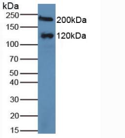 MGAM / Maltase-Glucoamylase Antibody - Western Blot; Sample: Human Serum.