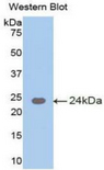 MGAM / Maltase-Glucoamylase Antibody - Western blot of recombinant MGAM / Alpha-Glucosidase.  This image was taken for the unconjugated form of this product. Other forms have not been tested.