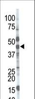 MGAT / GLYT1 Antibody - The anti-MGAT1 antibody is used in Western blot to detect MGAT1 in mouse brain tissue lysate.