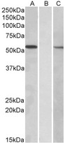 MGAT / GLYT1 Antibody - HEK293 lysate (10ug protein in RIPA buffer) overexpressing Human MGAT1 with C-terminal MYC tag probed with (1ug/ml) in Lane A and probed with anti-MYC Tag (1/1000) in lane C. Mock-transfected HEK293 probed (1mg/ml) in Lane B. Primary