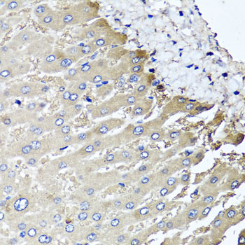 MGAT / GLYT1 Antibody - Immunohistochemistry of paraffin-embedded human liver injury using MGAT1 antibody at dilution of 1:100 (x40 lens).