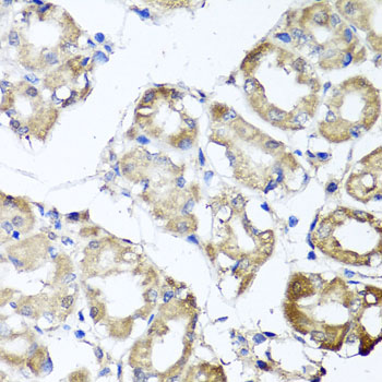 MGAT / GLYT1 Antibody - Immunohistochemistry of paraffin-embedded human gastric using MGAT1 antibody at dilution of 1:100 (x40 lens).
