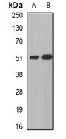 MGAT / GLYT1 Antibody - Western blot analysis of MGAT1 expression in human liver (A); human gastric (B) whole cell lysates.