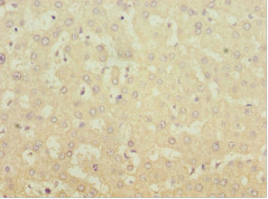 MGAT / GLYT1 Antibody - Immunohistochemistry of paraffin-embedded human liver tissue at dilution 1:100