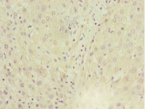 MGAT / GLYT1 Antibody - Immunohistochemistry of paraffin-embedded human liver tissue at dilution 1:100