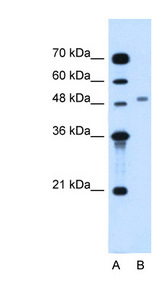 MGAT2 Antibody - MGAT2 antibody ARP44701_T100-NP_002399-MGAT2(mannosyl (alpha-1,6-)-glycoprotein beta-1,2-N-acetylglucosaminyltransferase) Antibody Western blot of Jurkat lysate.  This image was taken for the unconjugated form of this product. Other forms have not been tested.