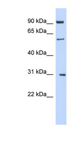 MGAT2 Antibody - MGAT2 antibody Western blot of 293T cell lysate. This image was taken for the unconjugated form of this product. Other forms have not been tested.