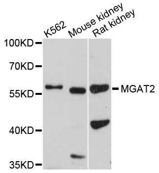 MGAT2 Antibody - Western blot analysis of extracts of various cell lines.