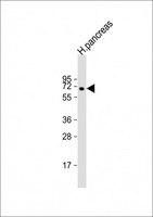 MGAT4B Antibody - Anti-MGAT4B Antibody (N-Term) at 1:2000 dilution + human pancreas lysate Lysates/proteins at 20 ug per lane. Secondary Goat Anti-Rabbit IgG, (H+L), Peroxidase conjugated at 1:10000 dilution. Predicted band size: 63 kDa. Blocking/Dilution buffer: 5% NFDM/TBST.