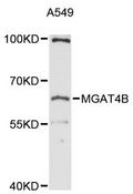 MGAT4B Antibody - Western blot analysis of extracts of A-549 cells, using MGAT4B antibody at 1:3000 dilution. The secondary antibody used was an HRP Goat Anti-Rabbit IgG (H+L) at 1:10000 dilution. Lysates were loaded 25ug per lane and 3% nonfat dry milk in TBST was used for blocking. An ECL Kit was used for detection and the exposure time was 30s.
