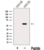 MGAT4C Antibody - Western blot analysis of extracts of mouse testis tissue using MGAT4C antibody. The lane on the left was treated with blocking peptide.