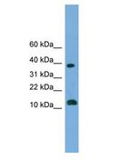 MGAT4D Antibody - LOC152586 antibody Western Blot of THP-1 cell lysate.  This image was taken for the unconjugated form of this product. Other forms have not been tested.