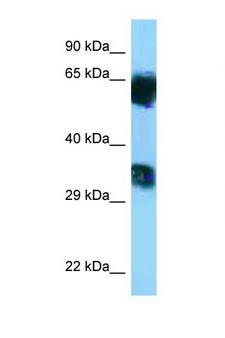 MGAT5B Antibody - Mgat5b antibody Western blot of Rat Muscle lysate. Antibody concentration 1 ug/ml.  This image was taken for the unconjugated form of this product. Other forms have not been tested.