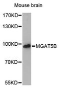 MGAT5B Antibody - Western blot analysis of extracts of mouse brain, using MGAT5B antibody at 1:3000 dilution. The secondary antibody used was an HRP Goat Anti-Rabbit IgG (H+L) at 1:10000 dilution. Lysates were loaded 25ug per lane and 3% nonfat dry milk in TBST was used for blocking. An ECL Kit was used for detection and the exposure time was 90s.