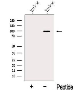 MGAT5B Antibody - Western blot analysis of extracts of Jurkat cells using MGAT5B antibody. The lane on the left was treated with blocking peptide.