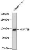 MGAT5B Antibody - Western blot analysis of extracts of mouse brain using MGAT5B Polyclonal Antibody at dilution of 1:3000.