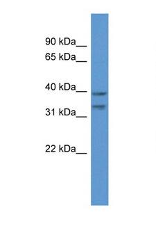 MGC11296 / BRMS1L Antibody - BRMS1L antibody Western blot of ACHN Cell lysate. Antibody concentration 1 ug/ml.  This image was taken for the unconjugated form of this product. Other forms have not been tested.