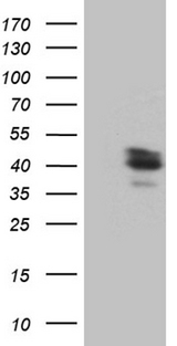 MGC11296 / BRMS1L Antibody - HEK293T cells were transfected with the pCMV6-ENTRY control. (Left lane) or pCMV6-ENTRY BRMS1L. (Right lane) cDNA for 48 hrs and lysed