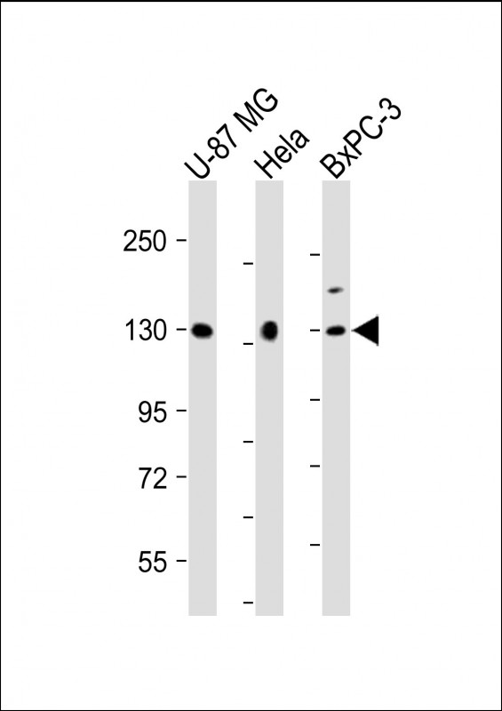 MGEA5 Antibody - All lanes: Anti-MGEA5 Antibody (N-Term) at 1:2000 dilution Lane 1: U-87 MG whole cell lysate Lane 2: Hela whole cell lysate Lane 3: BxPC-3 whole cell lysate Lysates/proteins at 20 µg per lane. Secondary Goat Anti-Rabbit IgG, (H+L), Peroxidase conjugated at 1/10000 dilution. Predicted band size: 103 kDa Blocking/Dilution buffer: 5% NFDM/TBST.