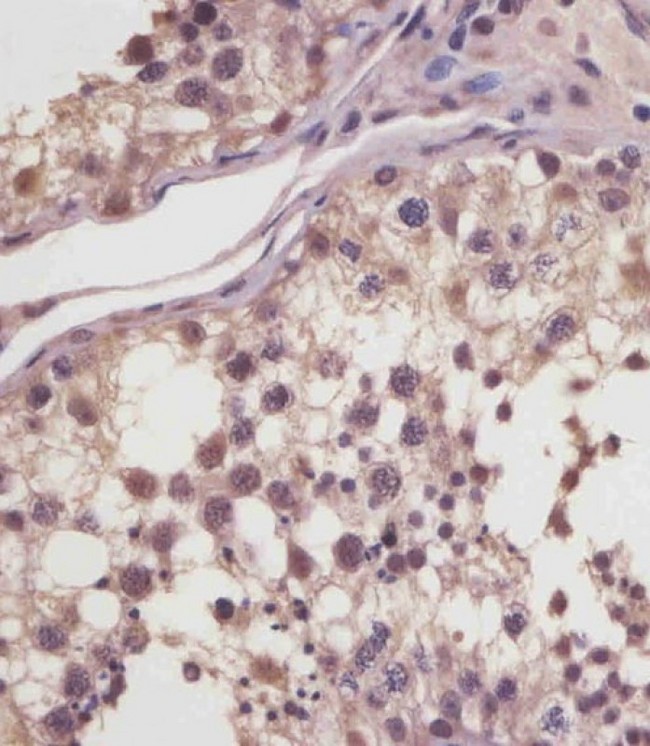 MGEA5 Antibody - MGEA5 Antibody (N-Term) staining MGEA5 in human testis tissue sections by Immunohistochemistry (IHC-P - paraformaldehyde-fixed, paraffin-embedded sections). Tissue was fixed with formaldehyde and blocked with 3% BSA for 0. 5 hour at room temperature; antigen retrieval was by heat mediation with a citrate buffer (pH6). Samples were incubated with primary antibody (1/25) for 1 hours at 37°C. A undiluted biotinylated goat polyvalent antibody was used as the secondary antibody.