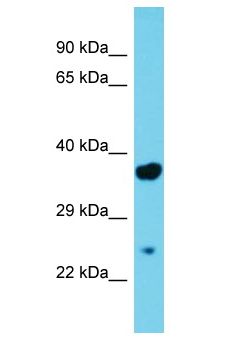 MGLL / Monoacylglycerol Lipase Antibody - MGLL / MGL antibody Western Blot of Rat Pancreas. Antibody dilution: 1 ug/ml.  This image was taken for the unconjugated form of this product. Other forms have not been tested.
