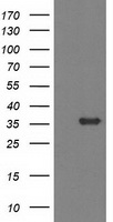 MGLL / Monoacylglycerol Lipase Antibody - HEK293T cells were transfected with the pCMV6-ENTRY control (Left lane) or pCMV6-ENTRY MGLL (Right lane) cDNA for 48 hrs and lysed. Equivalent amounts of cell lysates (5 ug per lane) were separated by SDS-PAGE and immunoblotted with anti-MGLL.