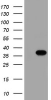 MGLL / Monoacylglycerol Lipase Antibody - HEK293T cells were transfected with the pCMV6-ENTRY control (Left lane) or pCMV6-ENTRY MGLL (Right lane) cDNA for 48 hrs and lysed. Equivalent amounts of cell lysates (5 ug per lane) were separated by SDS-PAGE and immunoblotted with anti-MGLL.