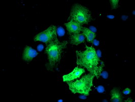 MGLL / Monoacylglycerol Lipase Antibody - Anti-MGLL mouse monoclonal antibody immunofluorescent staining of COS7 cells transiently transfected by pCMV6-ENTRY MGLL.