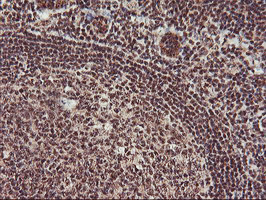 MGLL / Monoacylglycerol Lipase Antibody - IHC of paraffin-embedded Human tonsil using anti-MGLL mouse monoclonal antibody.