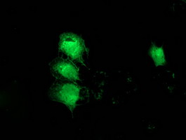 MGLL / Monoacylglycerol Lipase Antibody - Anti-MGLL mouse monoclonal antibody immunofluorescent staining of COS7 cells transiently transfected by pCMV6-ENTRY MGLL.