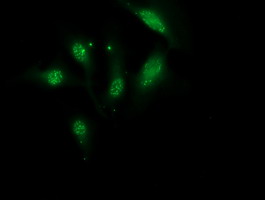 MGLL / Monoacylglycerol Lipase Antibody - Immunofluorescent staining of HeLa cells using anti-MGLL mouse monoclonal antibody.