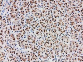 MGLL / Monoacylglycerol Lipase Antibody - IHC of paraffin-embedded Human pancreas tissue using anti-MGLL mouse monoclonal antibody. (Heat-induced epitope retrieval by 10mM citric buffer, pH6.0, 100C for 10min).