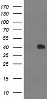 MGLL / Monoacylglycerol Lipase Antibody - HEK293T cells were transfected with the pCMV6-ENTRY control (Left lane) or pCMV6-ENTRY MGLL (Right lane) cDNA for 48 hrs and lysed. Equivalent amounts of cell lysates (5 ug per lane) were separated by SDS-PAGE and immunoblotted with anti-MGLL.