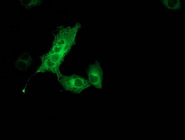MGLL / Monoacylglycerol Lipase Antibody - Anti-MGLL mouse monoclonal antibody immunofluorescent staining of COS7 cells transiently transfected by pCMV6-ENTRY MGLL.