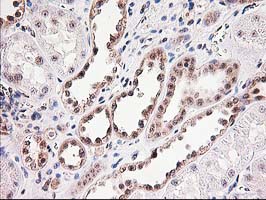 MGLL / Monoacylglycerol Lipase Antibody - IHC of paraffin-embedded Human Kidney tissue using anti-MGLL mouse monoclonal antibody.