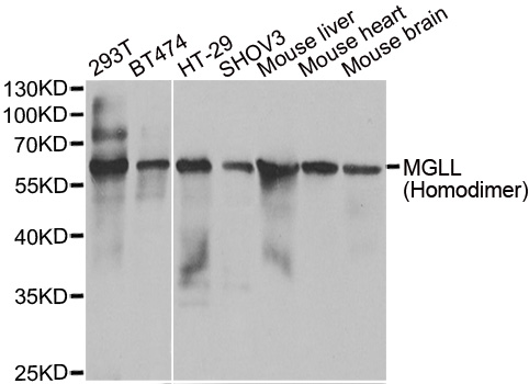 MGLL / Monoacylglycerol Lipase Antibody - Western blot analysis of extracts of various cell lines.