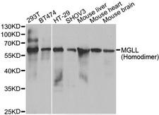 MGLL / Monoacylglycerol Lipase Antibody - Western blot analysis of extracts of various cell lines.