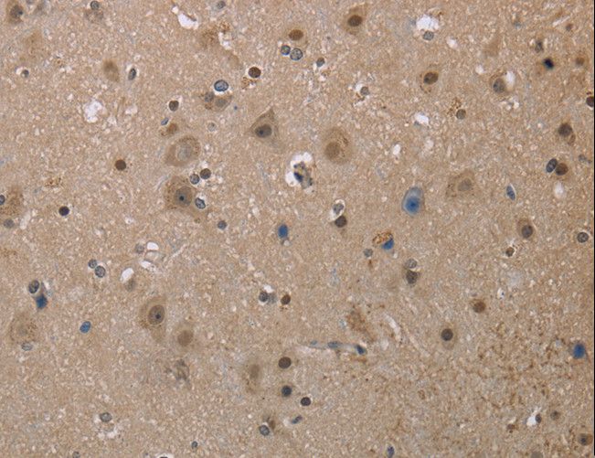 MGLL / Monoacylglycerol Lipase Antibody - Immunohistochemistry of paraffin-embedded Human brain using MGLL Polyclonal Antibody at dilution of 1:40.