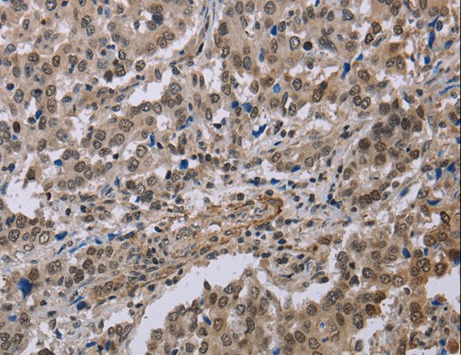 MGLL / Monoacylglycerol Lipase Antibody - Immunohistochemistry of paraffin-embedded Human brain using MGLL Polyclonal Antibody at dilution of 1:40.