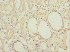 MGLL / Monoacylglycerol Lipase Antibody - Immunohistochemistry of paraffin-embedded human kidney tissue at dilution 1:100