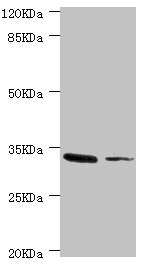 MGLL / Monoacylglycerol Lipase Antibody - Western blot All Lanes:MGLL antibody at 2.37ug/ml Lane 1:mouse liver tissue Lane 2:HT-29 whole cell lysate Secondary Goat polyclonal to rabbit at 1/10000 dilution Predicted band size: 34,32 kDa Observed band size: 33 kDa