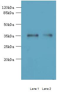 MGME1 / C20orf72 Antibody - Western blot. All lanes: MGME1 antibody at 1 ug/ml. Lane 1: Jurkat whole cell lysate. Lane 2: 293T whole cell lysate. Secondary Goat polyclonal to Rabbit IgG at 1:10000 dilution. Predicted band size: 39 kDa. Observed band size: 39 kDa.