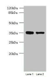MGME1 / C20orf72 Antibody - Western blot All lanes: MGME1 antibody at 1µg/ml Lane 1: Jurkat whole cell lysate Lane 2: 293T whole cell lysate Secondary Goat polyclonal to rabbit IgG at 1/10000 dilution Predicted band size: 39 kDa Observed band size: 39 kDa