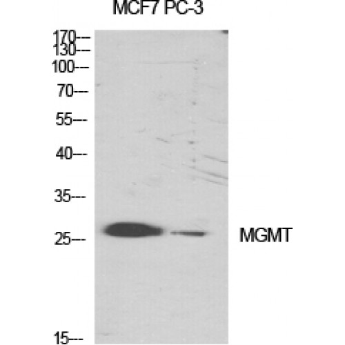 MGMT Antibody - Western blot of MGMT antibody