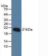 MGMT Antibody - Western Blot; Sample: Human Jurkat Cells.