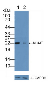 MGMT Antibody - Knockout Varification: Lane 1: Wild-type Jurkat cell lysate; Lane 2: MGMT knockout Jurkat cell lysate; Predicted MW: 21kd Observed MW: 22kd Primary Ab: 3µg/ml Rabbit Anti-Human MGMT Antibody Second Ab: 0.2µg/mL HRP-Linked Caprine Anti-Rabbit IgG Polyclonal Antibody