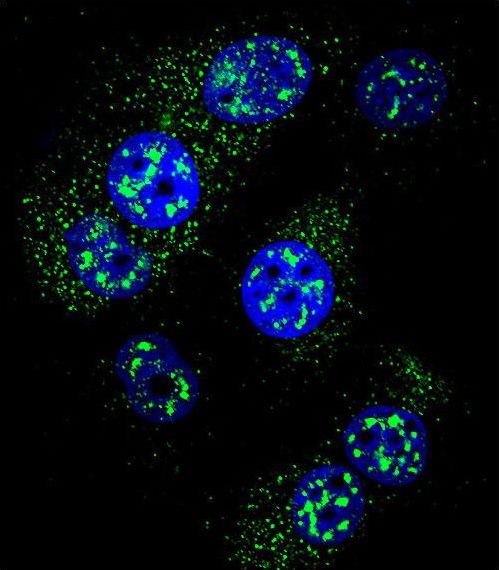 MGMT Antibody - Confocal immunofluorescence of MGMT Antibody with MCF-7 cell followed by Alexa Fluor 488-conjugated goat anti-rabbit lgG (green). DAPI was used to stain the cell nuclear (blue).